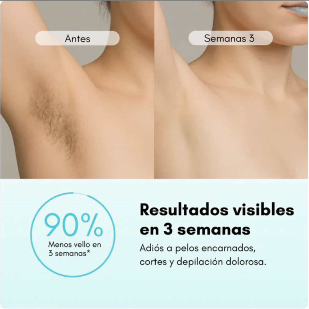 Depiladora de láser IPL